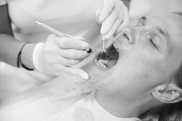 tratamiento periodontal